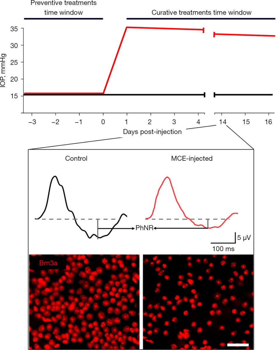 Figure 1 Summary of the typical outcomes deriving from the MCE-induced model of IOP elevation. Graphical representation of the time-dependent profile of IOP in control (black line) and following the intracameral injection of MCE (red line). The inset shows typical differences at 14 days post-injection between control and MCE-treated mice in PhNR retrieved from photopic ERG traces and in the density of RGCs immunolabeled for Brn3a. Scale bar: 50 μm. IOP, intraocular pressure; MCE, methyl cellulose; PhNR, photopic negative response; ERG, electroretinogram; RGCs, retinal ganglion cells.